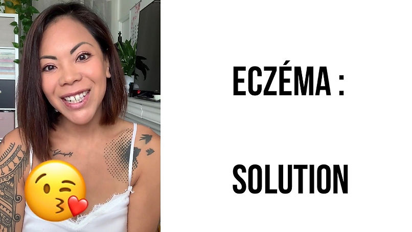 Eczema Solutions